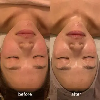 美sorciere所属・現役看護師サロン めぐみのエステ・リラクイメージ