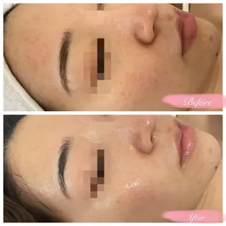 Voyage serein 【ヴォヤージュスラン】所属・心斎橋　Voyage serein🌙のマツエク・マツパデザイン