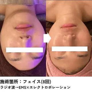 B-st. 下北沢のその他イメージ