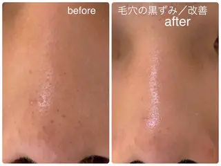 メンズ ヤスダ ユウコのエステ・リラクイメージ