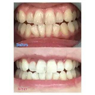 MBEAUTYSALON 千葉店・京成大久保所属・Melty 輝のその他イメージ