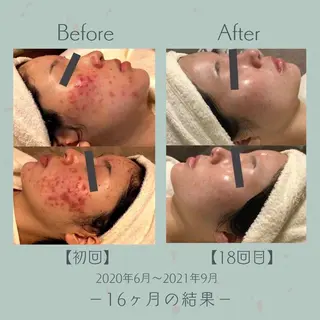 エステ＆美肌脱毛 ココサロ倉敷店のエステ・リラクイメージ