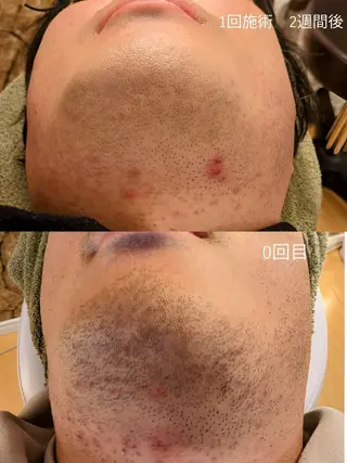 プライベートサロン宿り木所属・江坂@宿り木　脱毛＆ 耳ツボジュエリーのその他イメージ