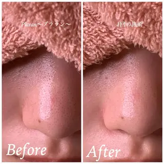 Plaran 〜プララン 〜のその他イメージ