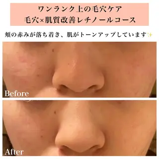 Bellesthe (ベルエステ)のエステ・リラクイメージ