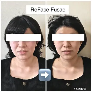 小顔矯正サロン　ReFace Fusae（リフェイスフサエ）所属・小顔矯正サロン リフェイスフサエのエステ・リラクイメージ