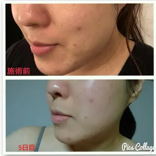 FLEUR大阪・美容 整体・痩身・小顔のエステ・リラクイメージ