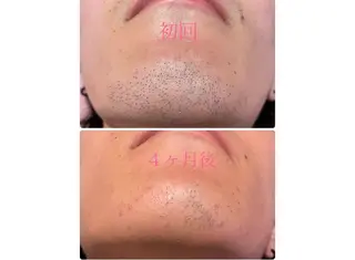 RAY Beauty エステ 一宮店のエステ・リラクイメージ