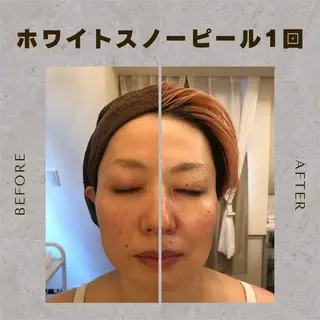 Salon de cheri サロンドシェリ人形町店所属・毛穴・シミ専門 松本瞳のエステ・リラクイメージ