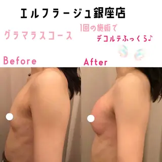 エルフラージュ 銀座店のエステ・リラクイメージ