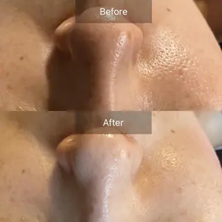 Mandarin Orange所属・毛穴から始める肌メン テマンダリンオレンジのエステ・リラクイメージ