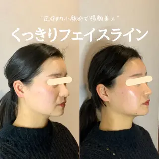 最速小顔・肌質管理 ❣️エスポワールのエステ・リラクイメージ