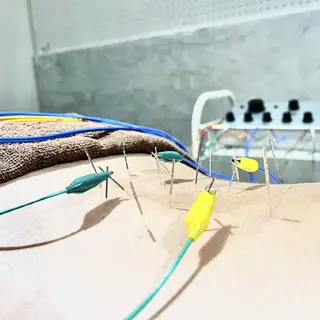 Spring鍼灸院所属・Spring鍼灸院 ✨首肩こり、腰痛に!のエステ・リラクイメージ