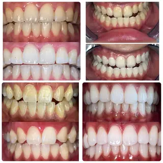 ホワイトニングサロンaile所属・セルフホワイトニング 金城しおりのその他イメージ