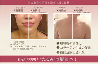 カラー ネイル マツエク・マツパ 小顔矯正・美容鍼 美鍼堂のエステ・リラクイメージ