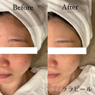 ハリラウンジ恵比寿 💫　Rinaのエステ・リラクイメージ