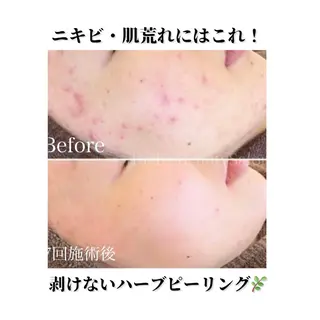 Rich+ ビューティーサロンのエステ・リラクイメージ