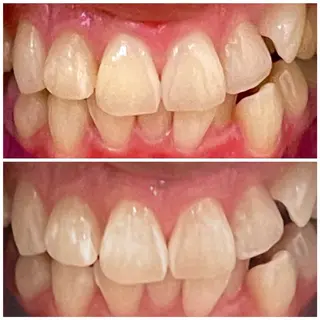 💎ダイヤモンド ホワイトニング渋谷のその他イメージ