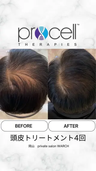 WARCH Marieのその他イメージ