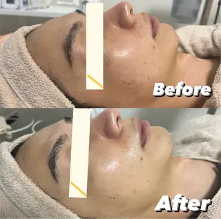 都度払い肌改善専門店 店長二上文香のエステ・リラクイメージ