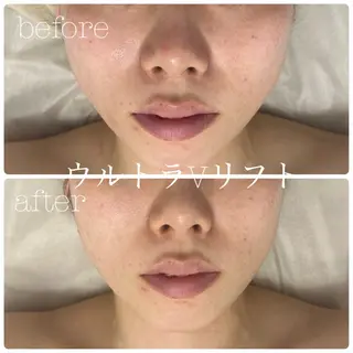 フェイシャルサロン CHIARA 荒田のエステ・リラクイメージ