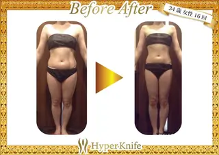 所沢痩身小顔コルギ AromaQueenのエステ・リラクイメージ