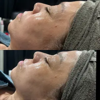 LiZA エステティックサロンのエステ・リラクイメージ