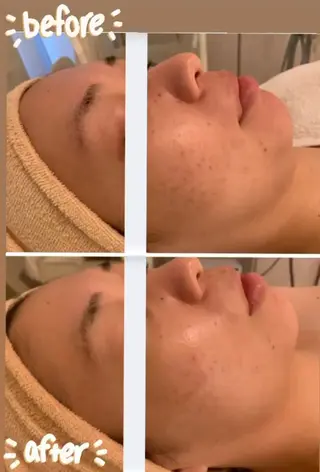 久屋大通フェイシャル エステ　POLAのエステ・リラクイメージ