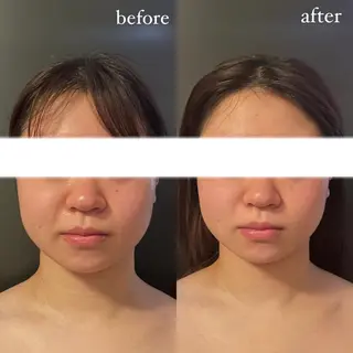 エステサロンino.colore'所属・小顔サロン ino.coloreのエステ・リラクイメージ