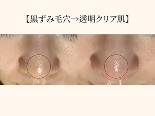 毛穴ケア専門サロン＆ドライヘッドスパ【毛穴洗浄 | ララピール】DREAM SPA町田店所属・毛穴ケア専門サロン DRRAMSPA町田のエステ・リラクイメージ
