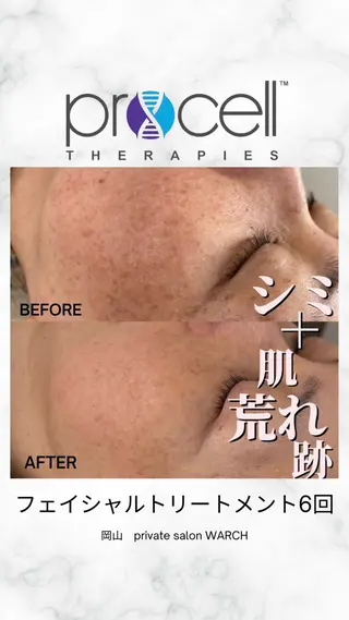 WARCH Marieのその他イメージ