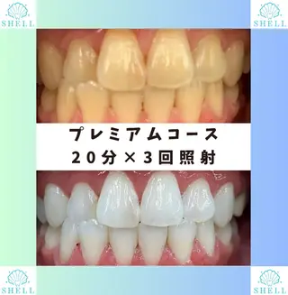 マツエク・マツパ メンズ キッズ セルフホワイトニングサロンSHELL所属・セルフホワイニング サロンSHELL木場のエステ・リラクイメージ
