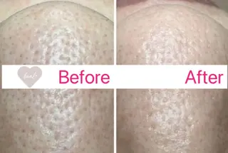 べアール所属・小顔/毛穴/白玉肌 salon bealのその他イメージ