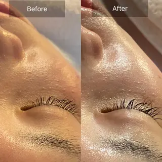 Mandarin Orange所属・毛穴から始める肌メン テマンダリンオレンジのエステ・リラクイメージ