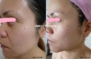 REGALO所属・矢野 さやかのエステ・リラクイメージ