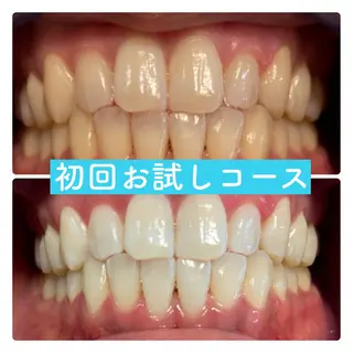 PLATINUM Beauty 横浜店所属・ホワイトニングルーム 横浜店のその他イメージ