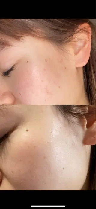 デコパーツが得意♪ ネイル/眉毛/エステの眉毛・アイブロウイメージ