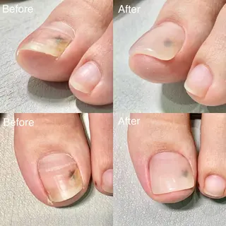 ネイル 小野 絵美のネイルデザイン