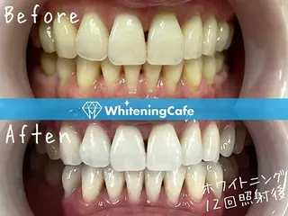 ホワイトニングカフェ中野店所属・ホワイトニングカフェ 中野店のその他イメージ