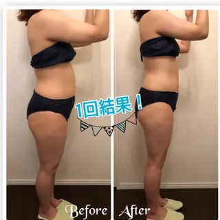 FLEUR大阪・美容 整体・痩身・小顔のエステ・リラクイメージ