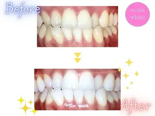 セルフホワイトニング エクシア五反田店のその他イメージ