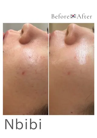 韓国🇰🇷価格 サロン_Nbibiのエステ・リラクイメージ