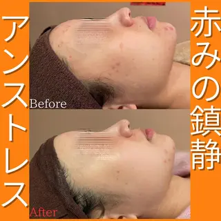 痩身&美肌サロン 遠藤🍊のエステ・リラクイメージ