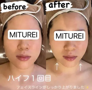 西区九条エステ MITUREIサロンのエステ・リラクイメージ