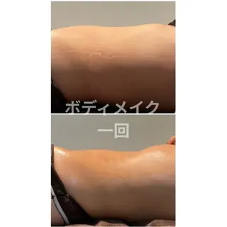 筋膜リリースエステ ESENCIAのエステ・リラクイメージ