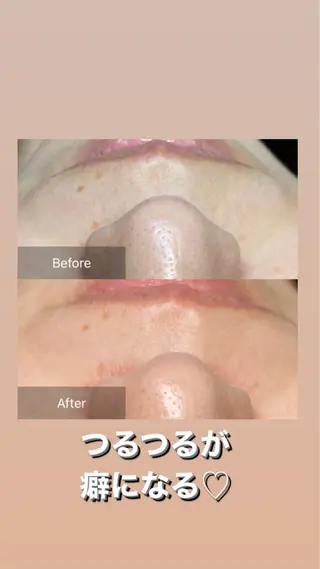 産毛専門店 Bittoのエステ・リラクイメージ