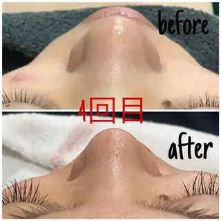 毛穴洗浄・痩身・脱毛 /アルカンジュのエステ・リラクイメージ