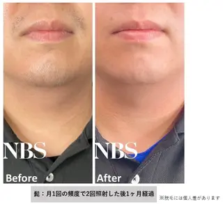 メンズ E'clat Kanaのエステ・リラクイメージ