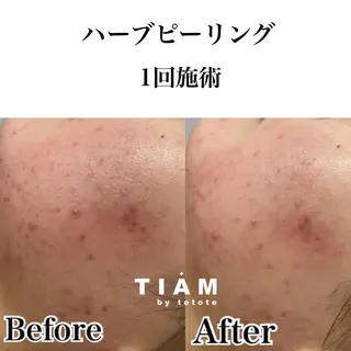 美肌サロンTIAM by tetoteのエステ・リラクイメージ