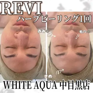 中目黒ハーブピーリン グ🌿ララピールのエステ・リラクイメージ